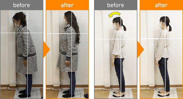 初回の整体でも効果を実感いただく方が多いです